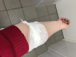 Фото порезанных рук в ванной